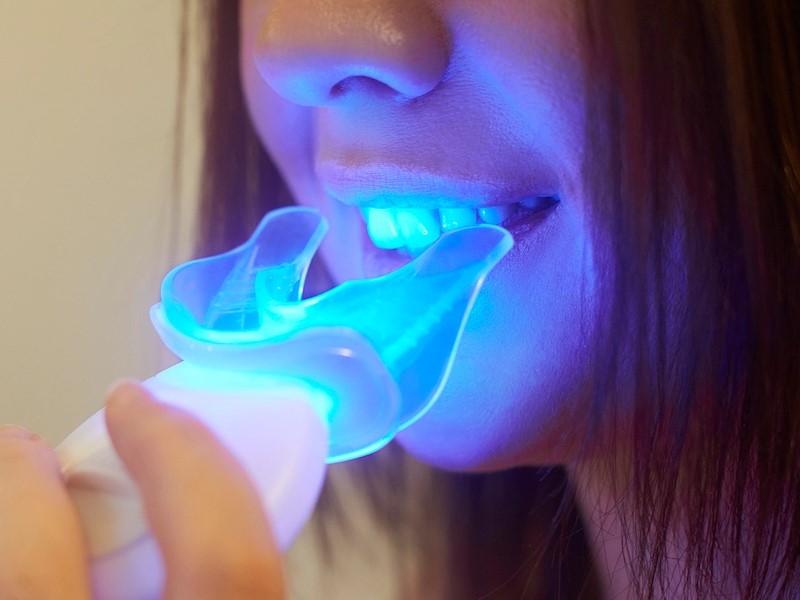 Some whitening kits sold online could put your oral health at risk